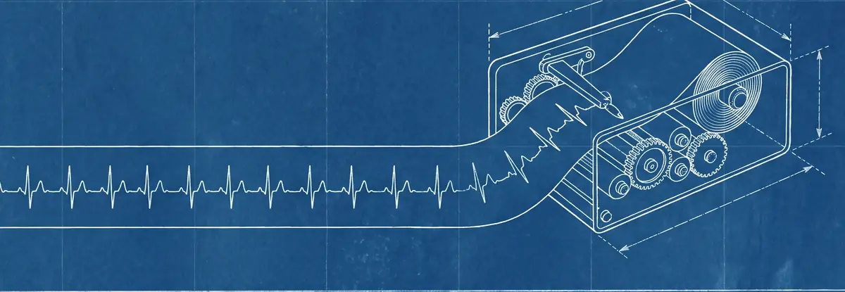 A blueprint drawing of a chart recorder feeding out a paper strip that carries one steady heartbeat line.