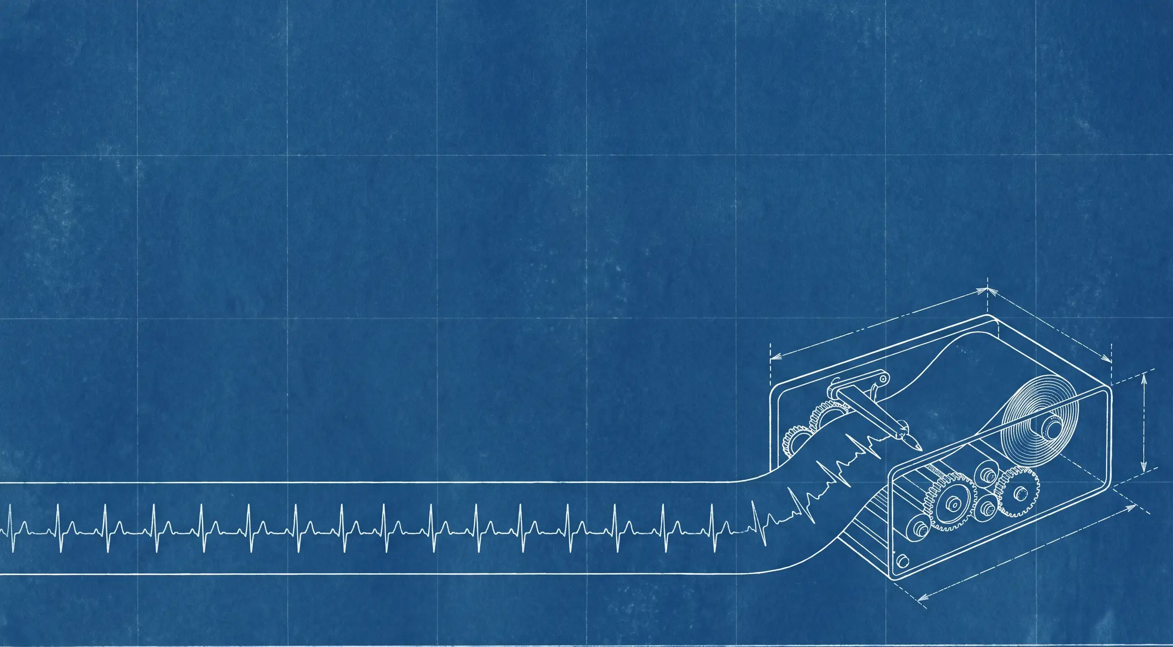 A blueprint drawing of a chart recorder, its paper strip running the full width of the sheet and carrying one steady heartbeat line.